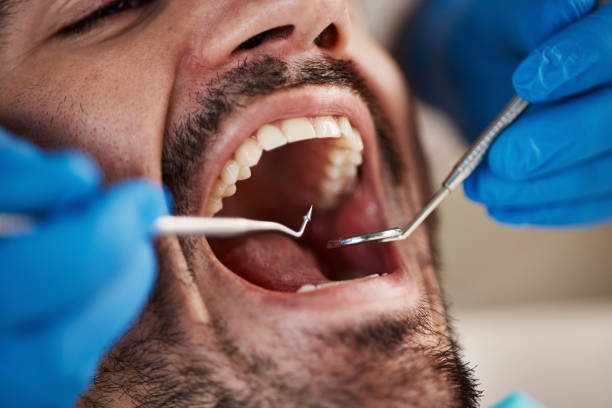 Teeth Whitening in NJ