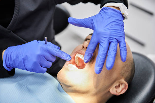 Best Dentist for Tooth Abscess  in Golden Triangle, NJ